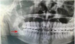 智齿在线观看,揭秘口腔健康与智慧生活新篇章